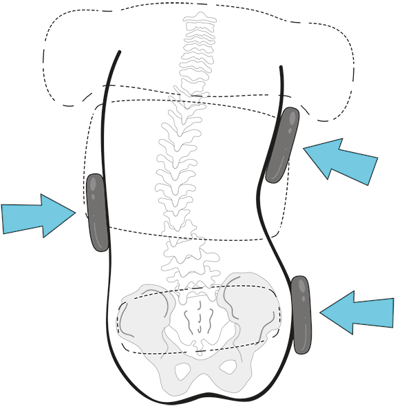 3-point loading spinal illustration