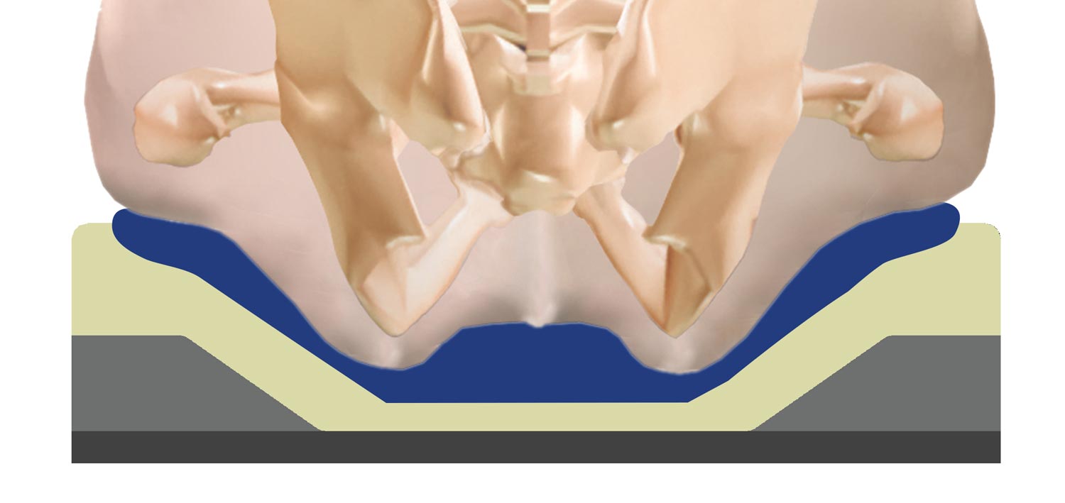 Pelvic Loading Area Determined by Common Skeletal Measurements